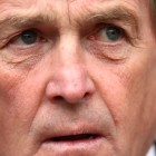 Kenny Dalglish Kenny Dalglish
