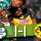 APERTURA 2011 | Santos 1-1 América APERTURA 2011 | Santos 1-1 América